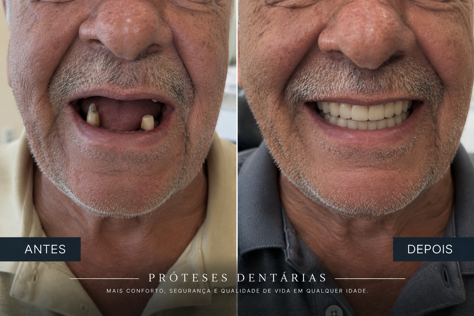 Imagem ilustrativa relacionada a Próteses Dentárias