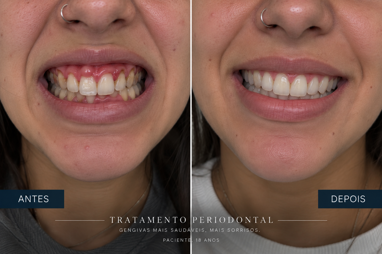 Imagem ilustrativa relacionada a Periodontia